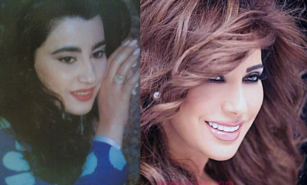 Arab Celebrities Before After